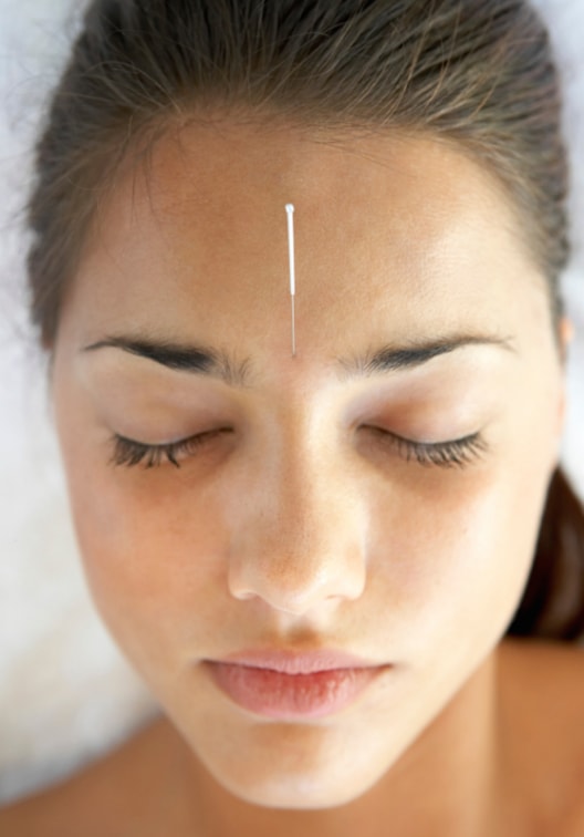 Acupuncture Pregnancy Experiences Healing InSightHealing InSight